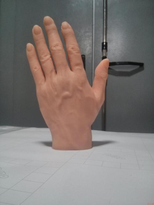 手指假肢安裝時注意事項以及手指假肢價格是多少(圖1) 手指假肢安裝時注意事項以及手指假肢價格是多少(圖1)