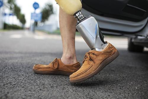 假肢價(jià)格力康假肢廠家制造出來(lái)產(chǎn)品性能優(yōu)勢(shì)(圖1) 假肢價(jià)格力康假肢廠家制造出來(lái)產(chǎn)品性能優(yōu)勢(shì)(圖1)