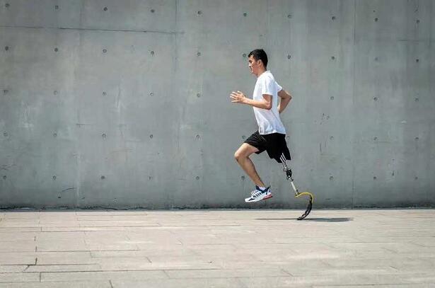 河南假肢廠家分享截肢者如何正確鍛煉做好恢復(圖1) 鄭州假肢廠家