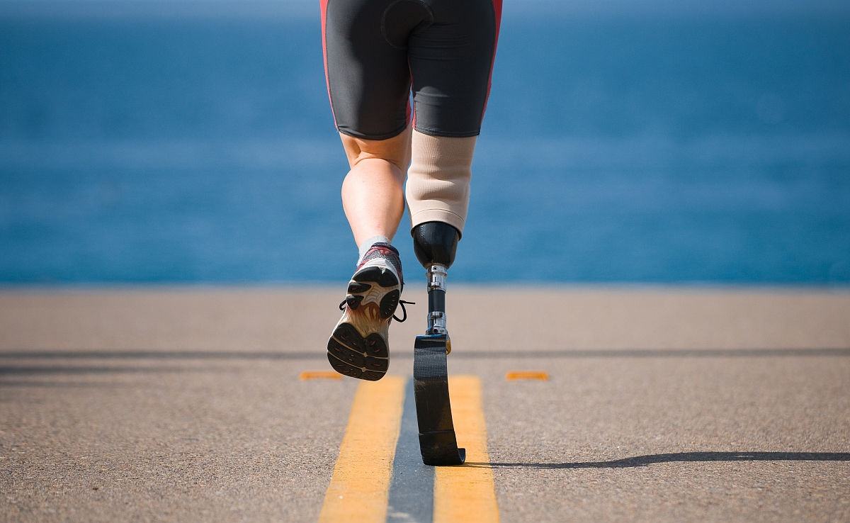 如何將假肢價格的優勢充分發揮出來?(圖1) 假肢價格